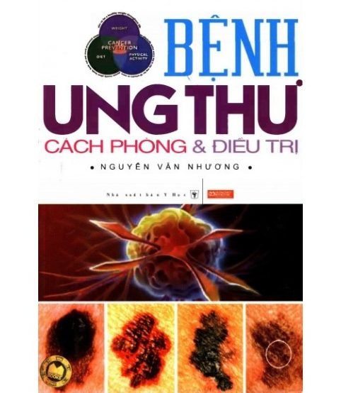 Bệnh ung thư cách phòng và điều trị