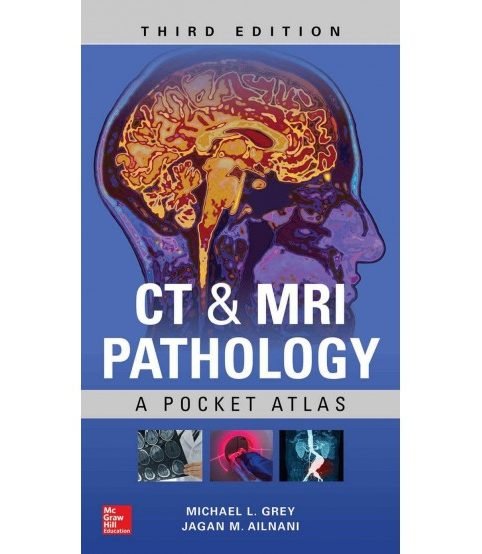 Bệnh lý học CT & MRI - Atlas bỏ túi (Ấn bản thứ ba)